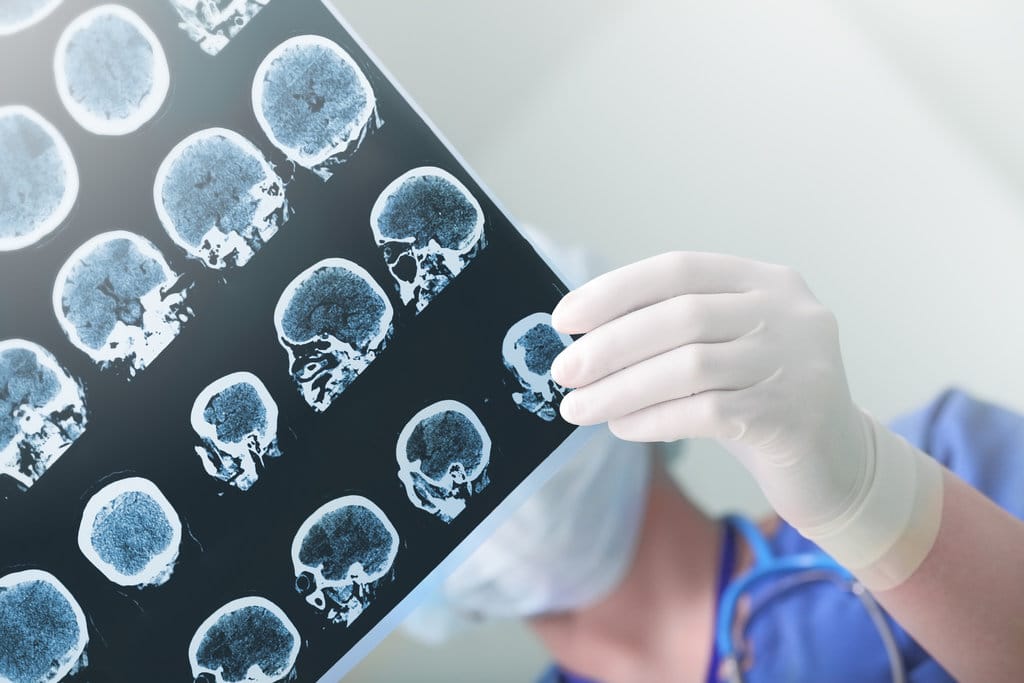 Ilustrasi EEG. Getty Images/iStockphoto Ilustrasi EEG