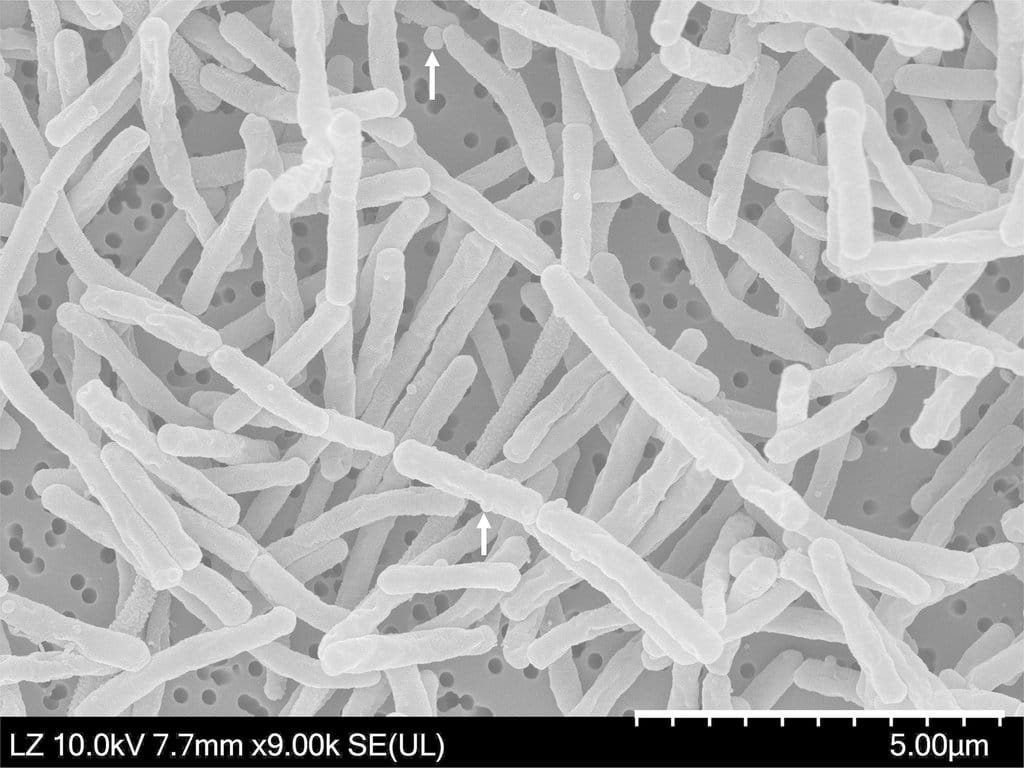 Thermus javaensis. foto/Microbiology.org Thermus javaensis