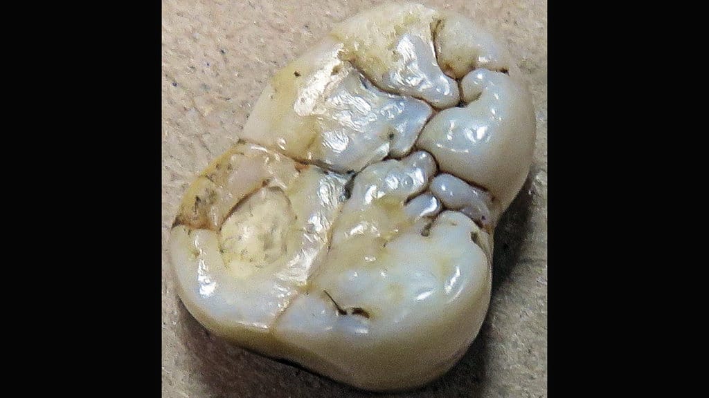 Fosil gigi geraham Giganthopithecus blacki. (FOTO/Gerbil/Wikipedia Commons) Fosil gigi geraham Giganthopithecus blacki