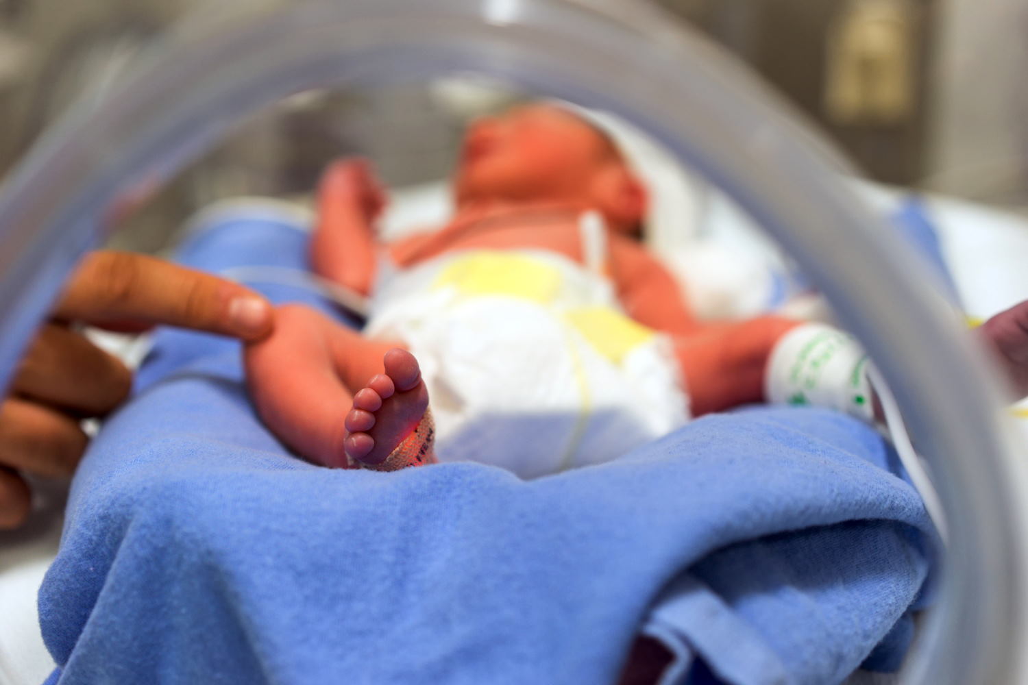 Risiko di Masa Depan Bagi Bayi Prematur 