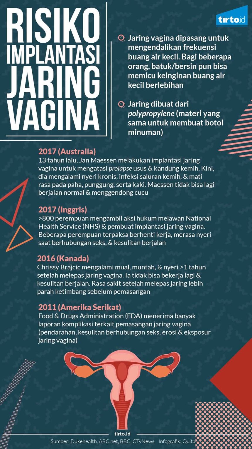 Infografik Risiko Implan Jaringan Vagina