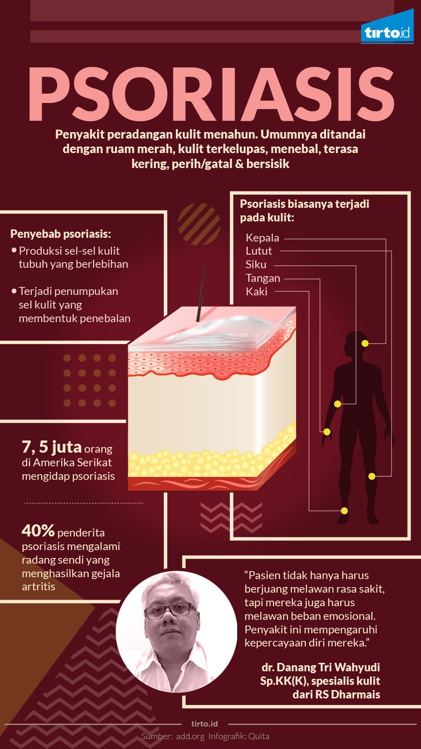 Infografik psoriasis