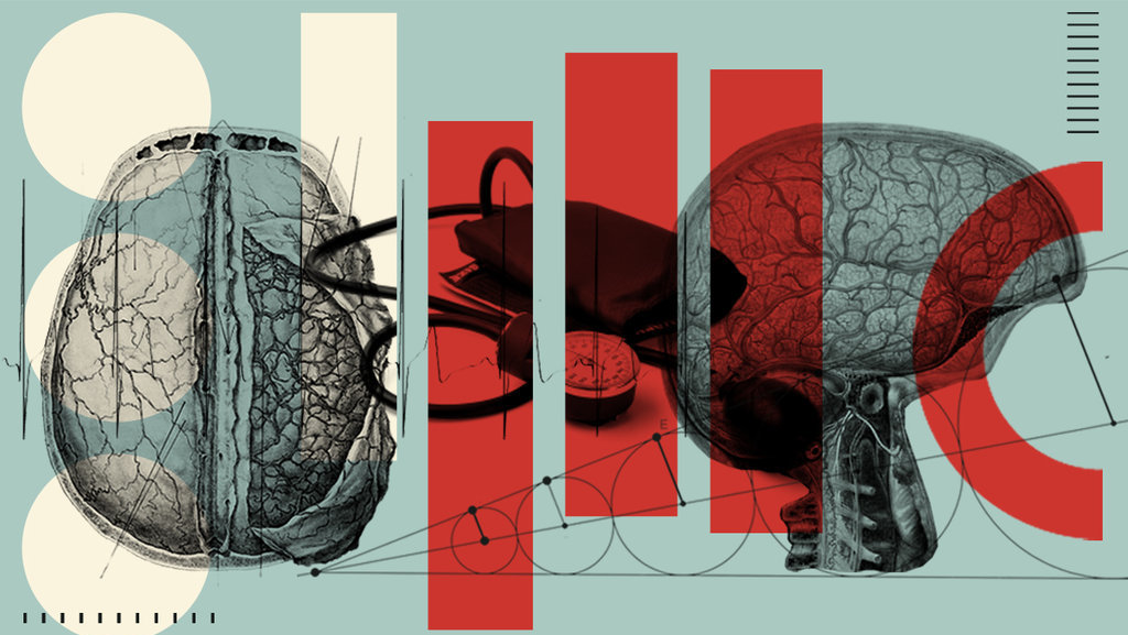 Hari Stroke Sedunia 2021 Sejarah Tema Dan Logo World Stroke Day