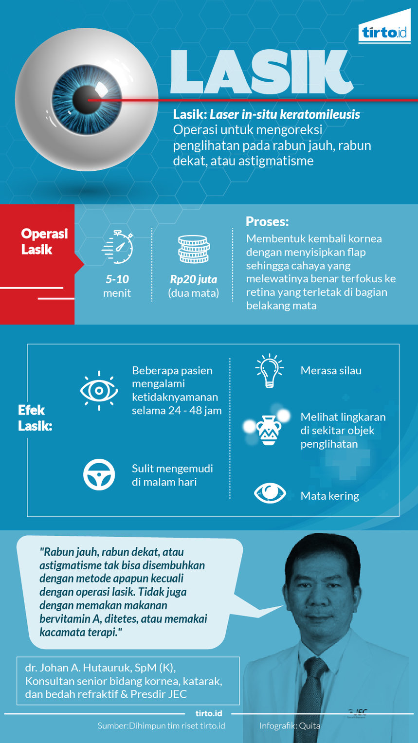 Infografik Lasik 