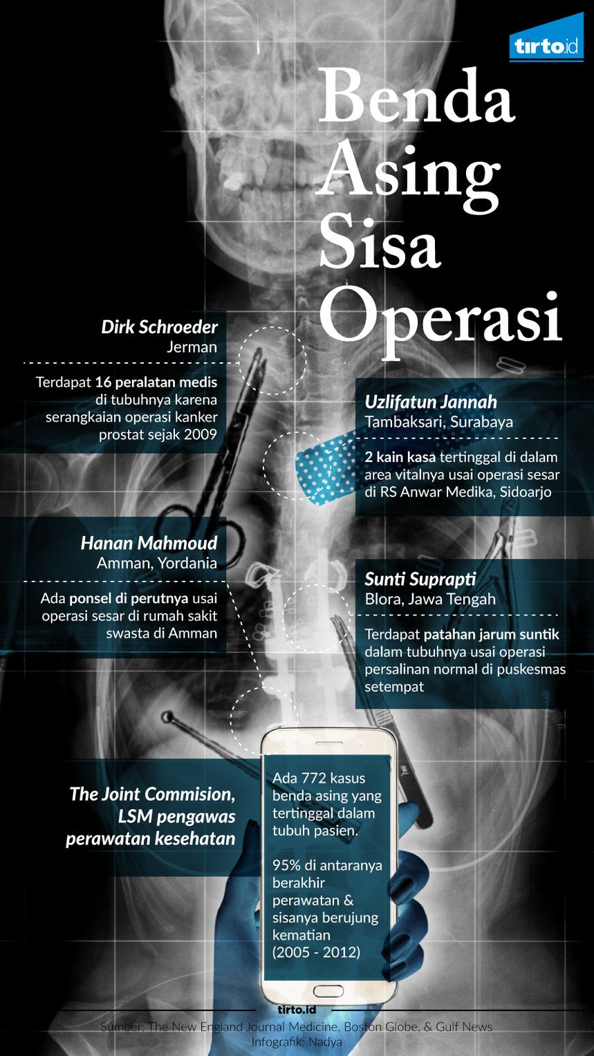 Infografik Benda asing sisa operasi 
