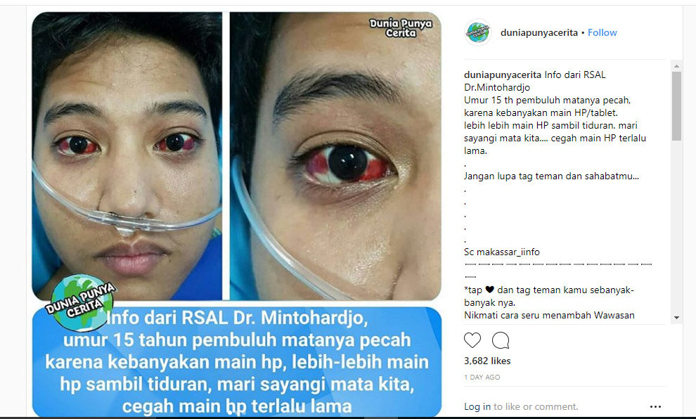 Pembuluh Darah Pecah Di Mata Info Kesehatan