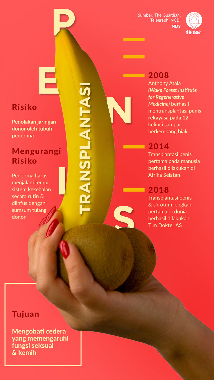 Infografik Transplantasi Penis