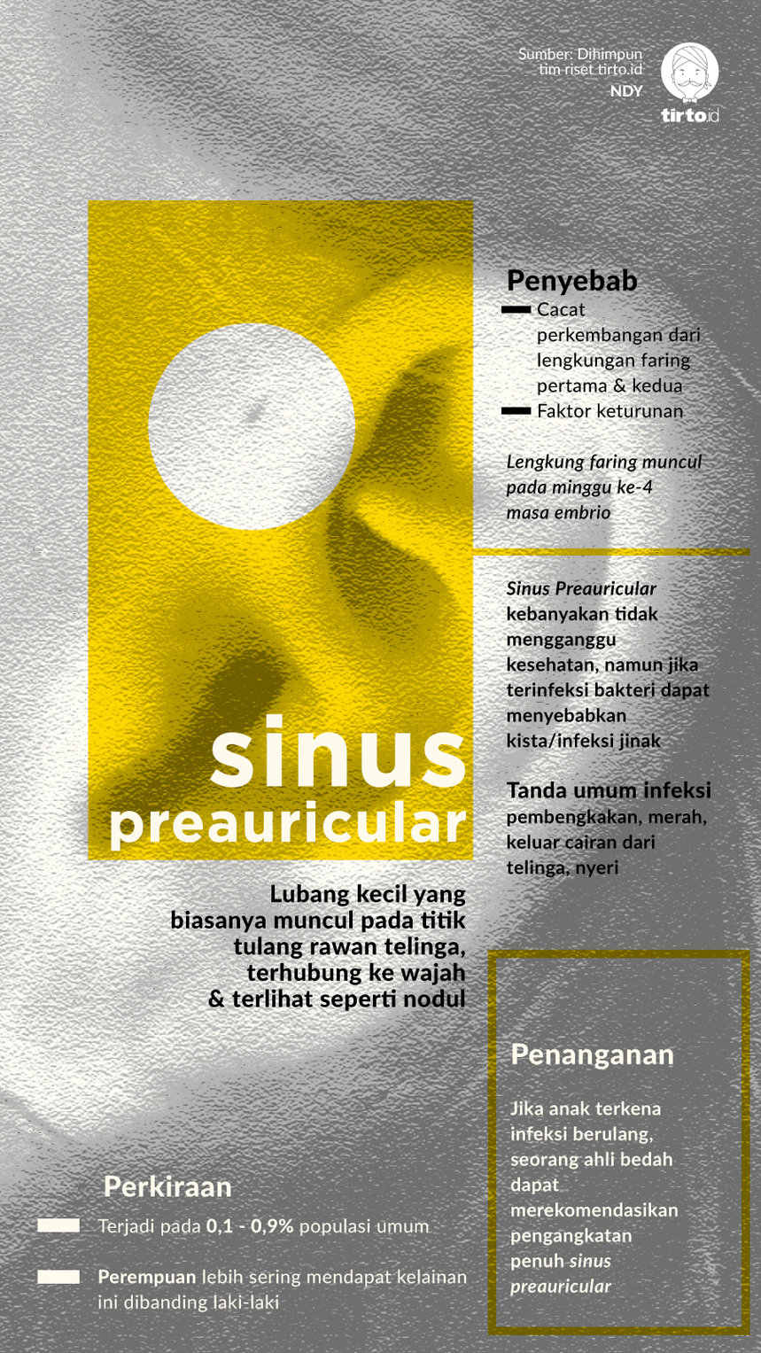 Infografik Sinus Preauricular