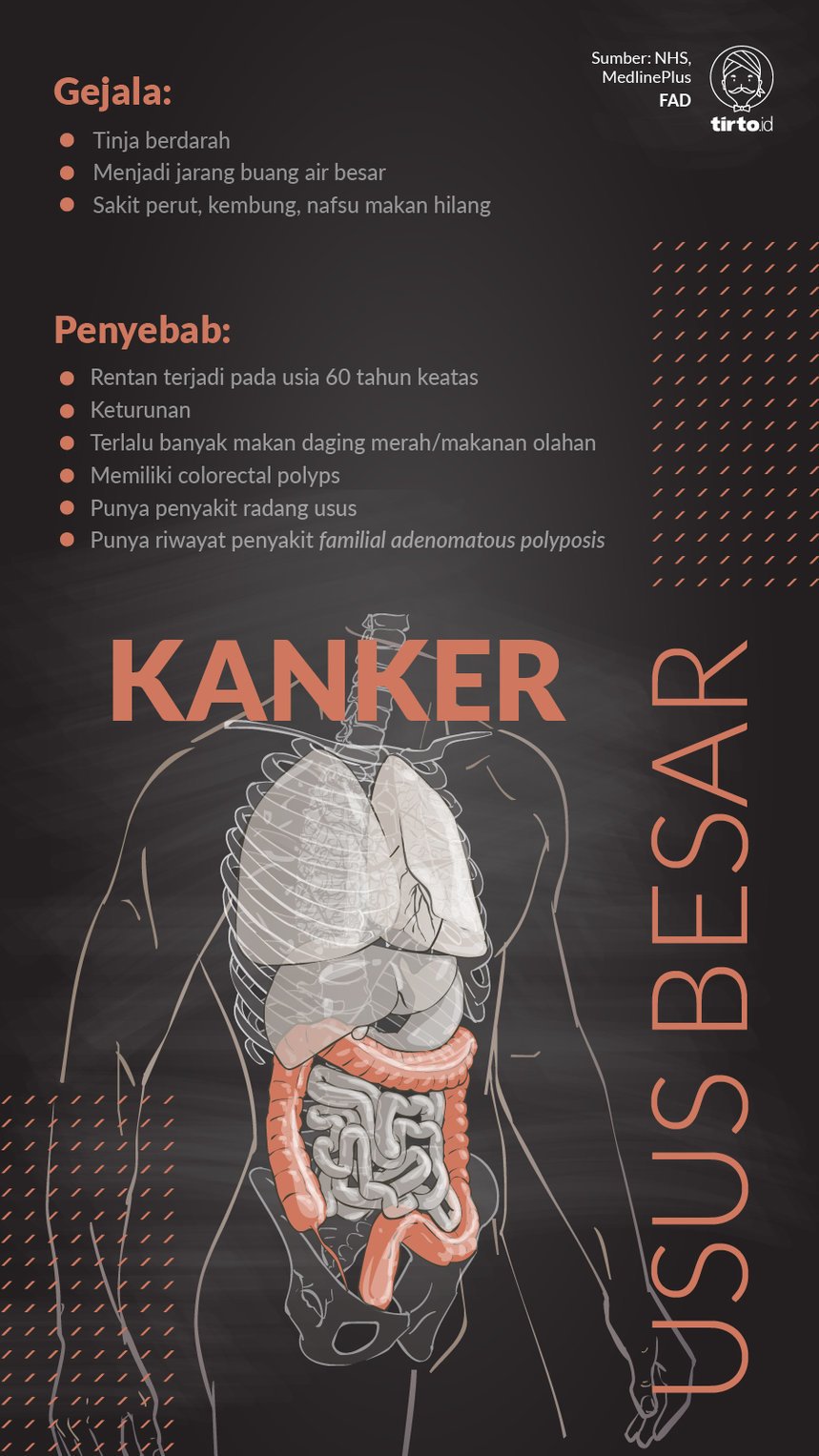 Infografik Kanker Usus Besar