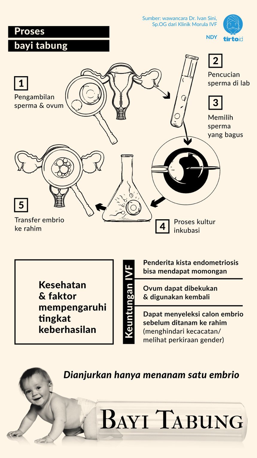 Infografik Proses bayi Tabung