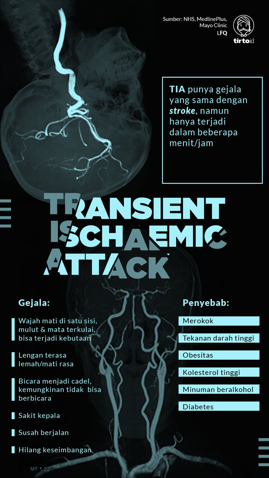 Infografik Transient ischaemic attack