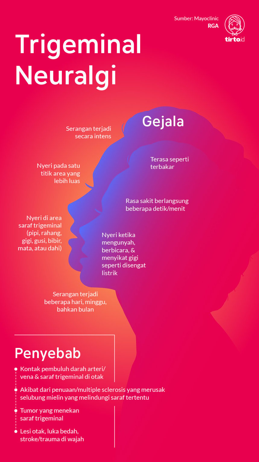 Infografik Trigeminal Neuralgi