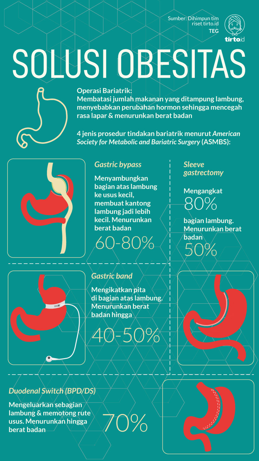 Infografik Solusi Obesitas