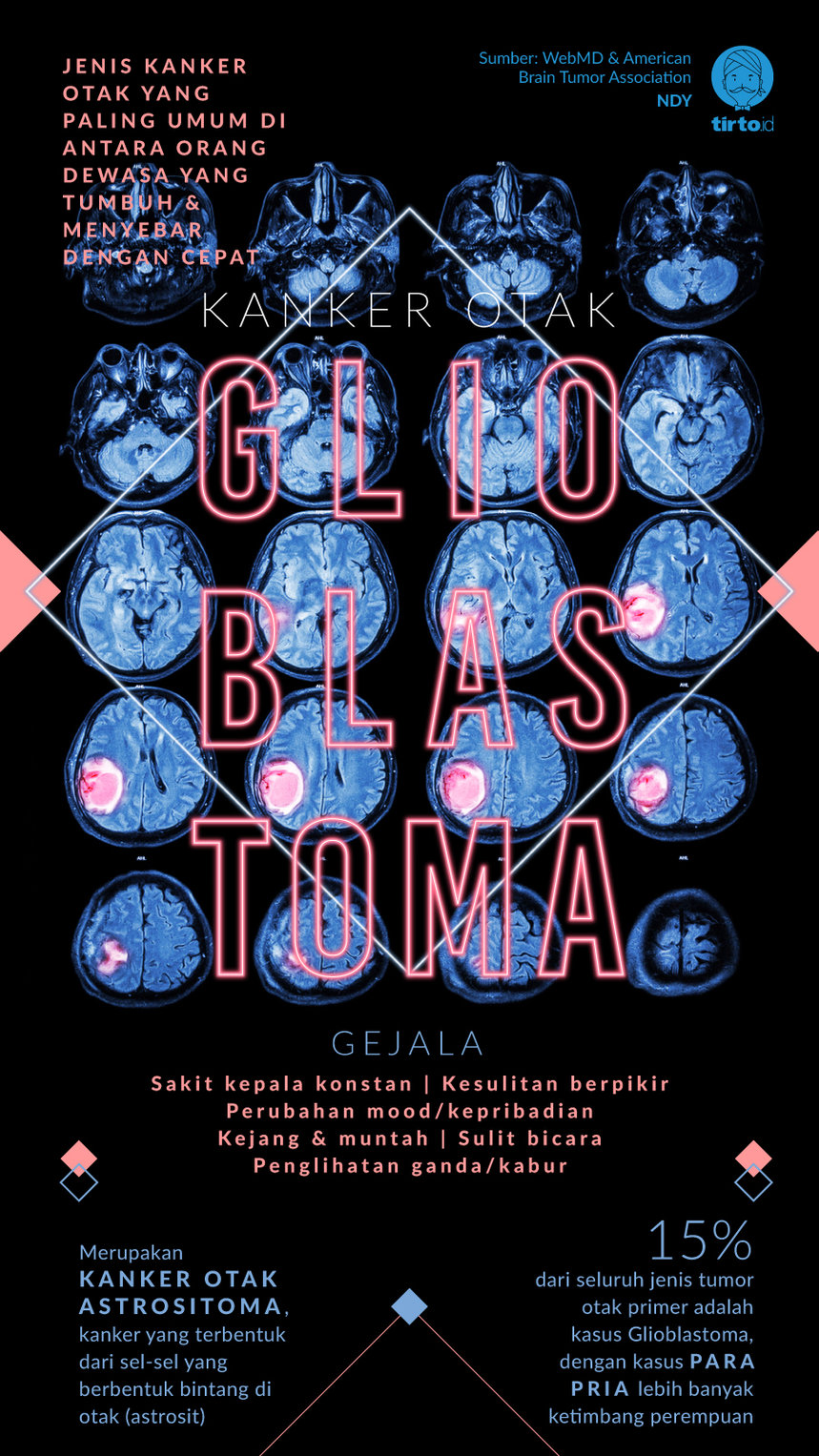 Infografik Kanker otak glioblastoma
