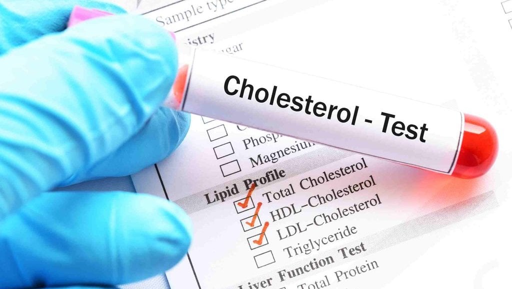 Ilustrasi kolesterol
