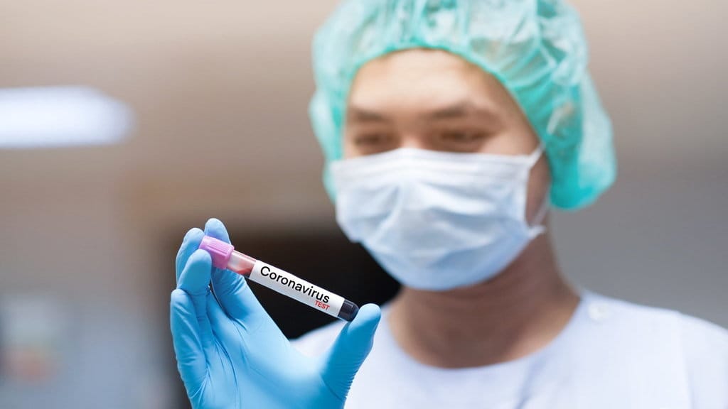Ahli Belum Ada Bukti Virus Corona Bisa Bertahan Di Makanan Tirto Id