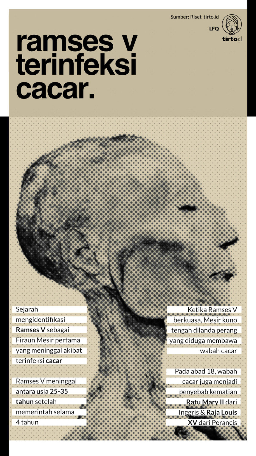 Infografik Ramses V Terinfeksi Cacar
