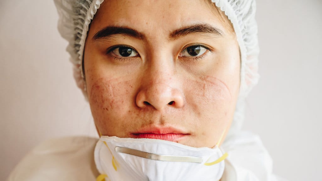 Penyebab Dan Solusi Jerawat Akibat Pakai Masker Menurut Dokter Tirto Id Penyebab Dan Solusi Jerawat Akibat Pakai Masker Menurut Dokter Tirto Id