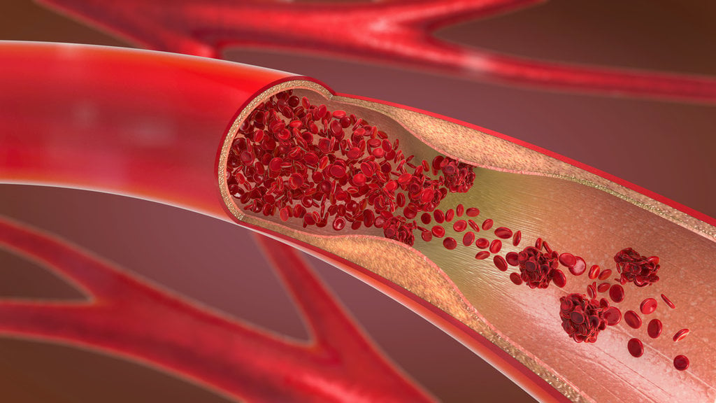 Mengenal Sel Darah & Fungsinya: Eritrosit, Leukosit Serta Trombosit