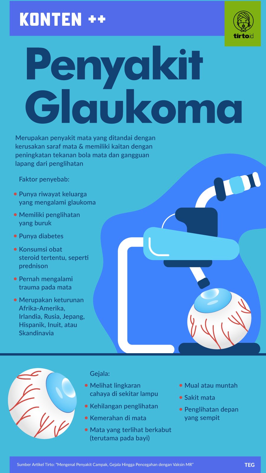 Infografik SC Penyakit Glaukoma