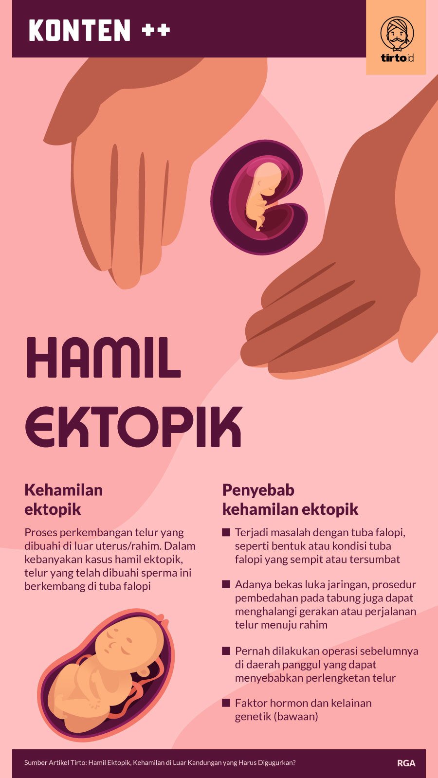 Infografik SC Hamil Ektopik