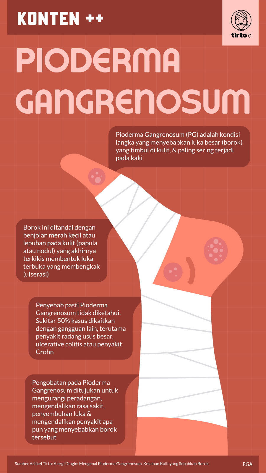 Infografik SC Pioderma Gangrenosum