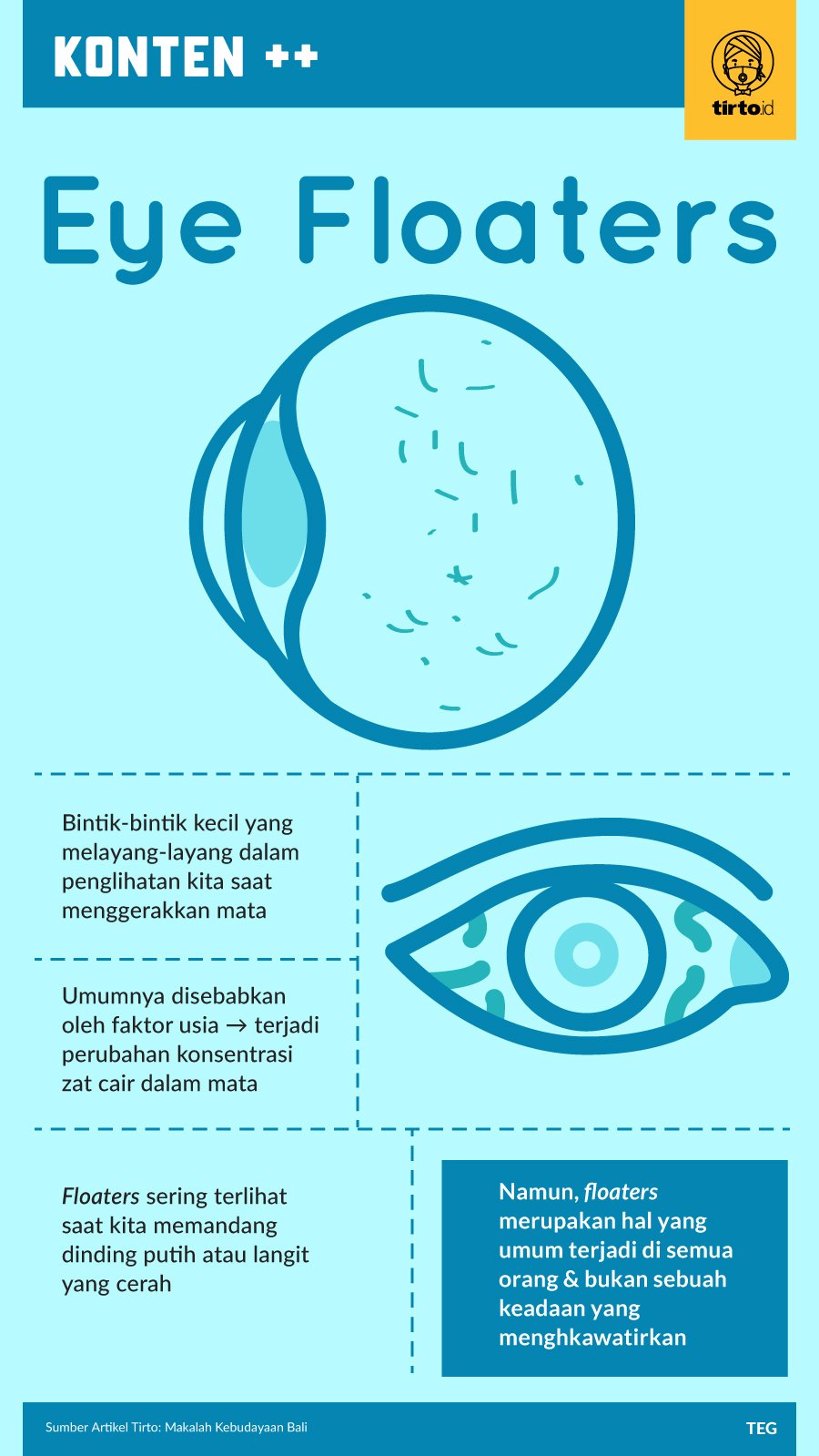 Infografik SC Eye Floaters