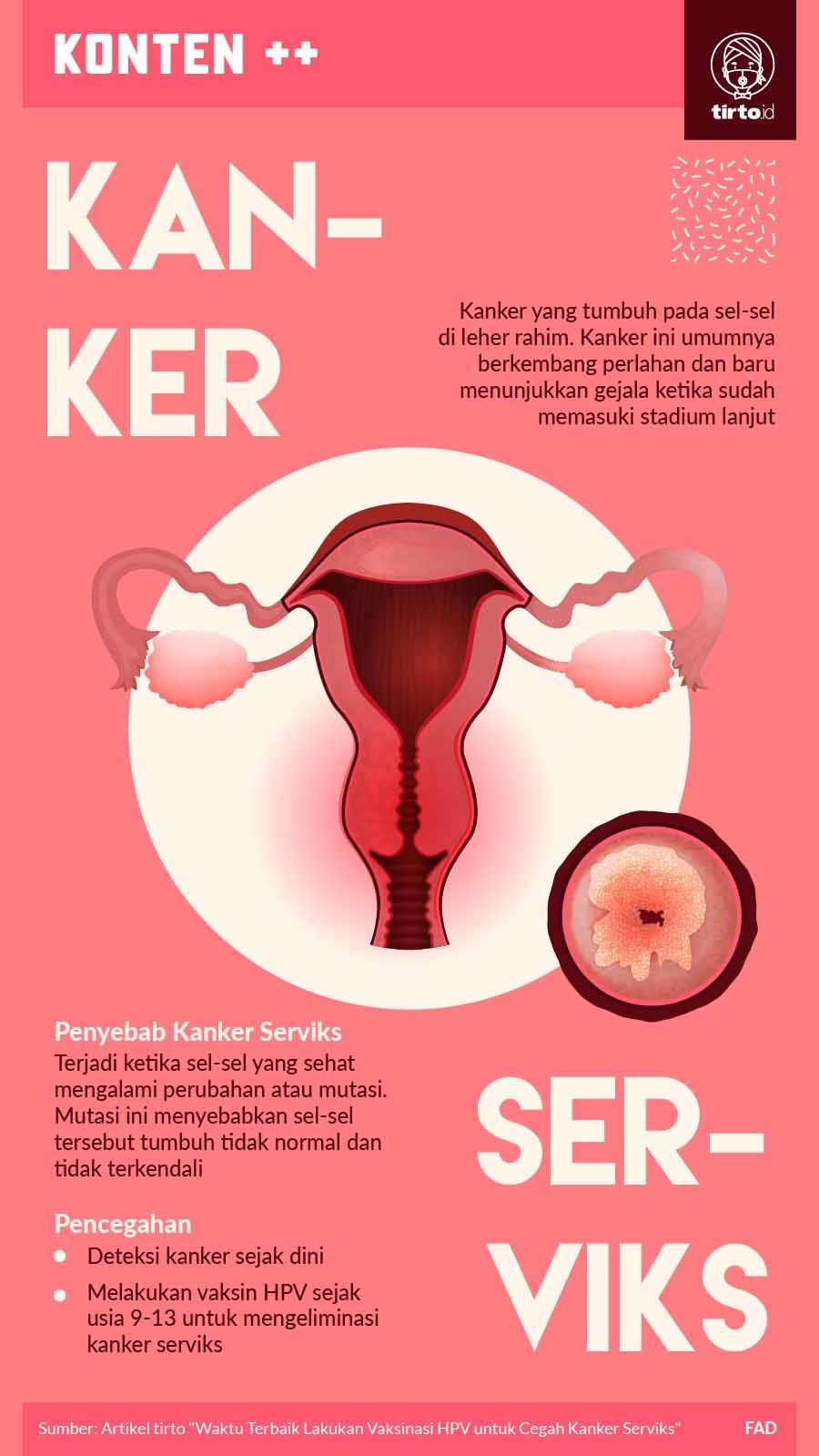 Infografik SC Kanker Serviks