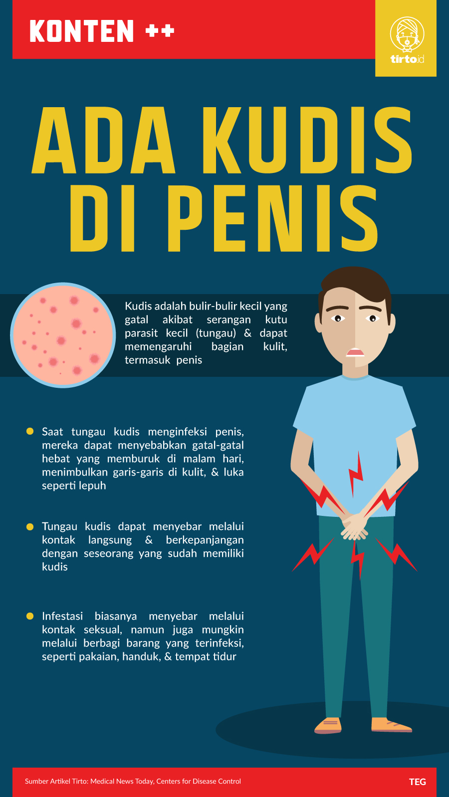Infografik SC Ada Kudis di Penis
