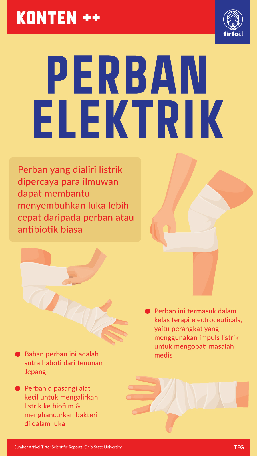 Infografik SC Perban Elektrik