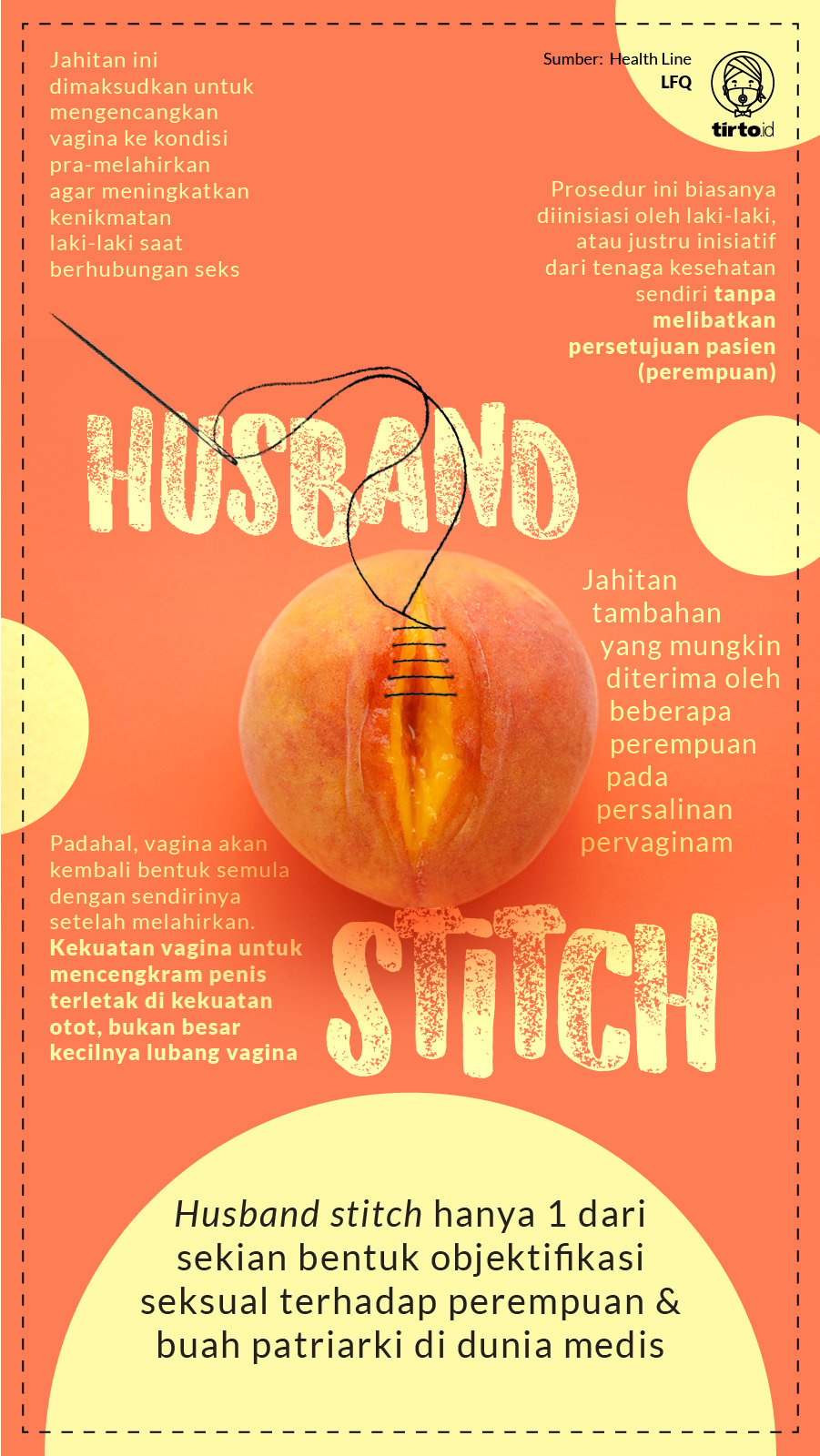 Infografik Husband Stitch