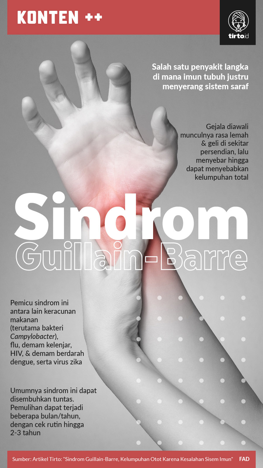 Infografik SC Sindrom Guillain Barre