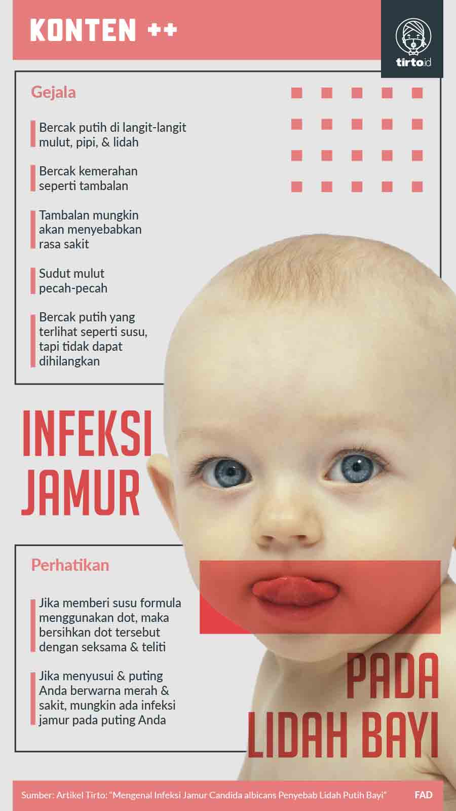Infografik SC Infeksi Jamur Pada Lidah Bayi