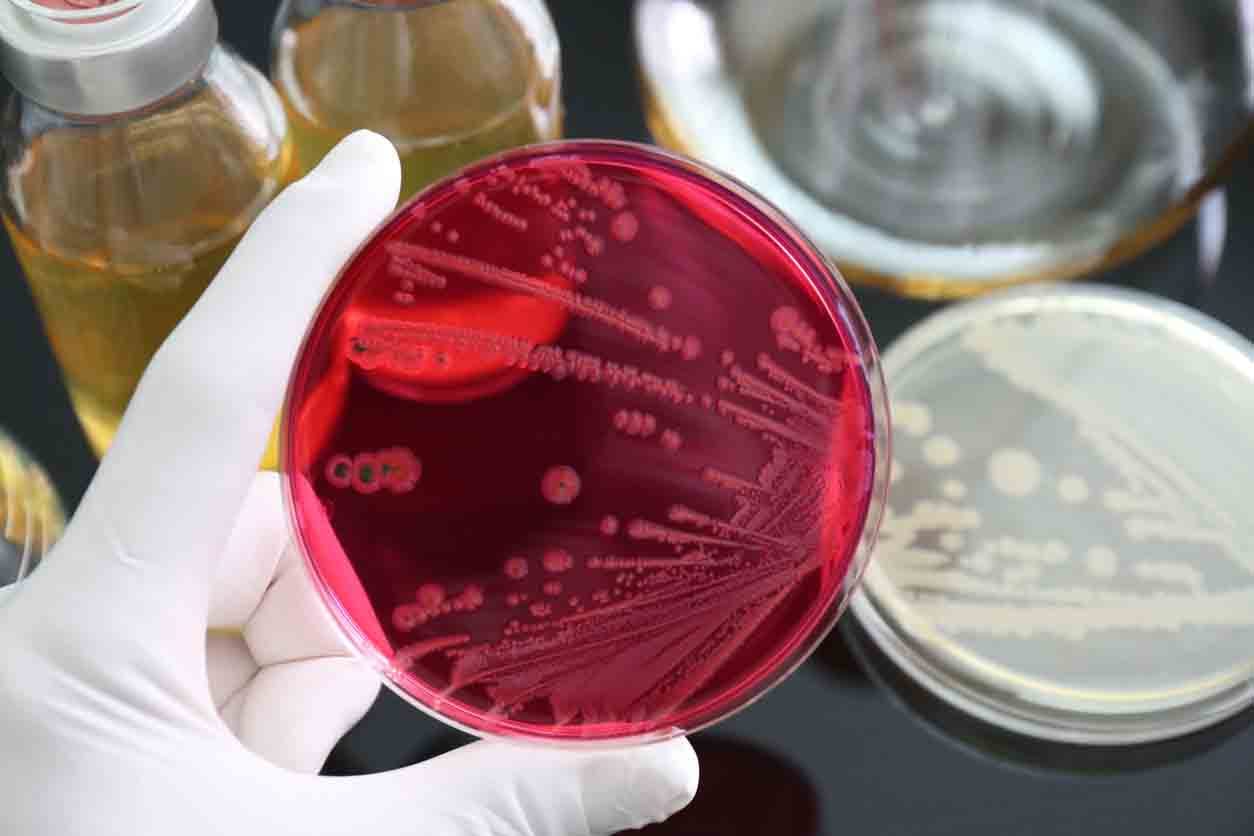 Ilustrasi Salmonella