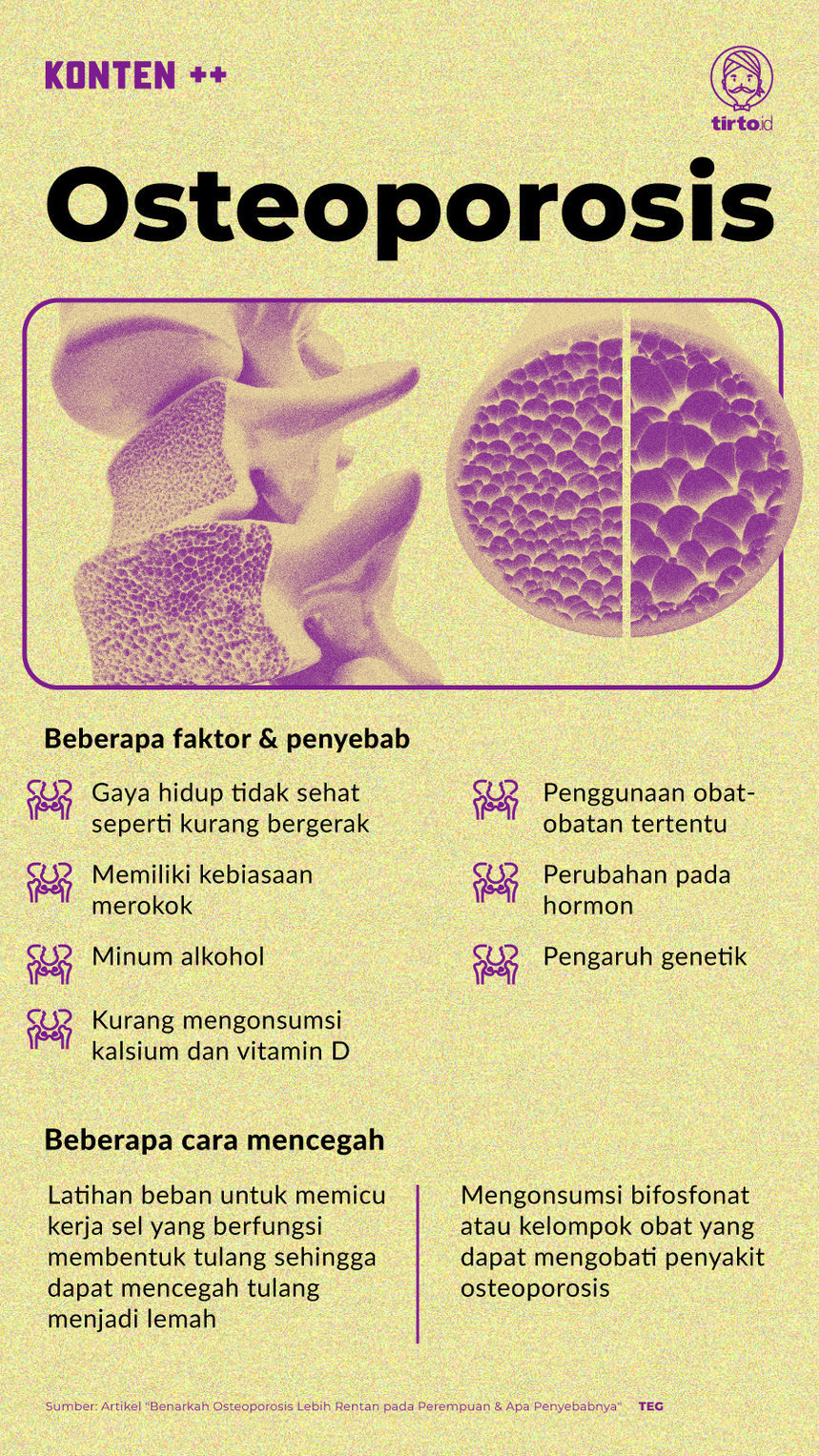 Infografik SC Osteoporosis