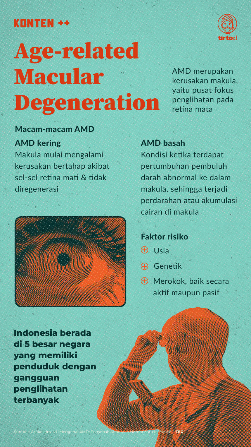 Infografik SC Age-related Macular Degeneration