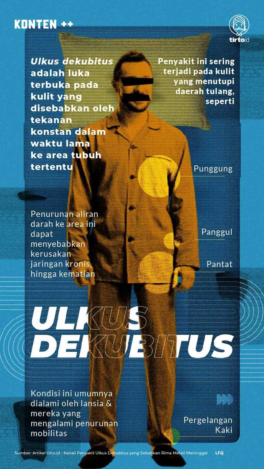 Infografik SC Ulkus Dekubitus