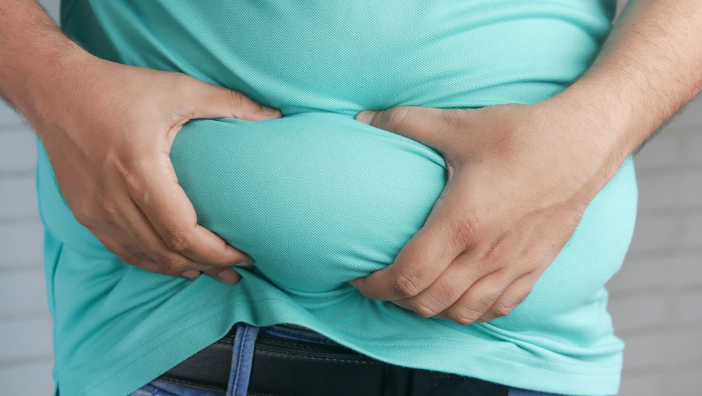 Ilustrasi obesitas. FOTO/iStockphoto Ilustrasi obesitas