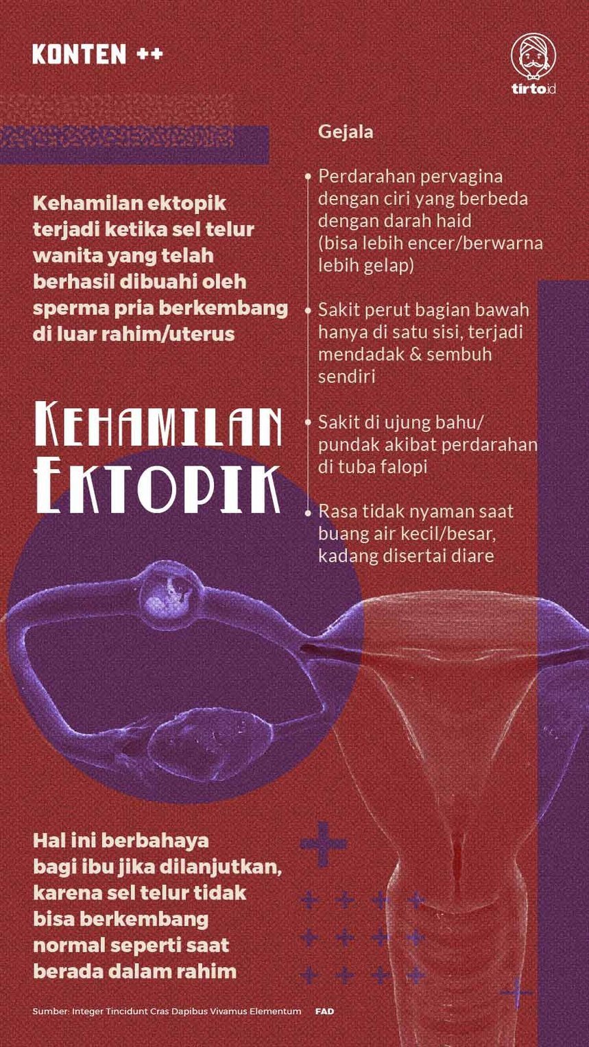 Infografik SC Kehamilan Ektopik