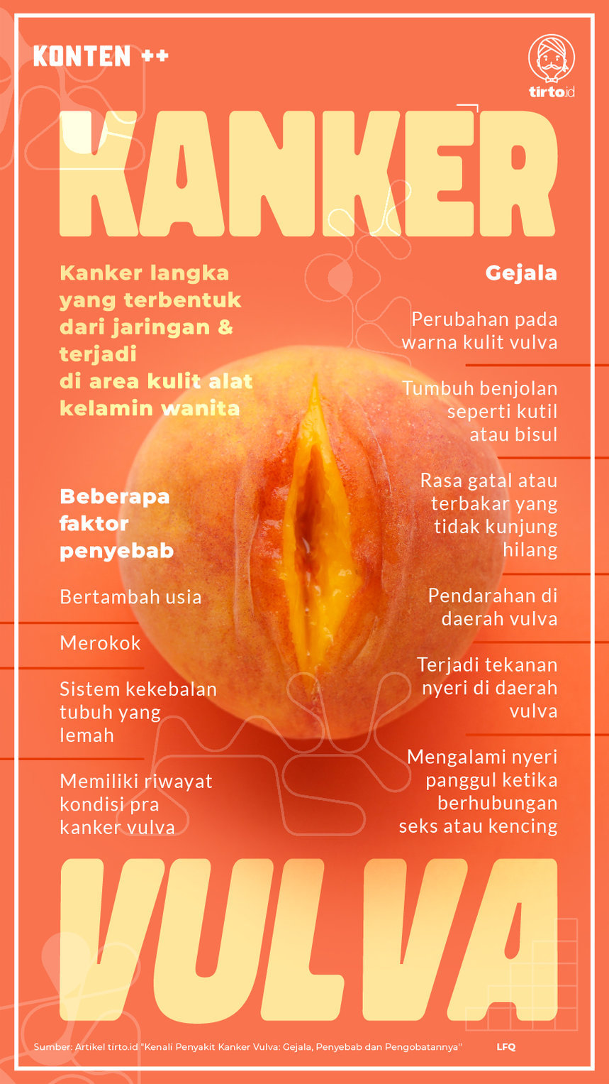 Infografik SC Kanker Vulva