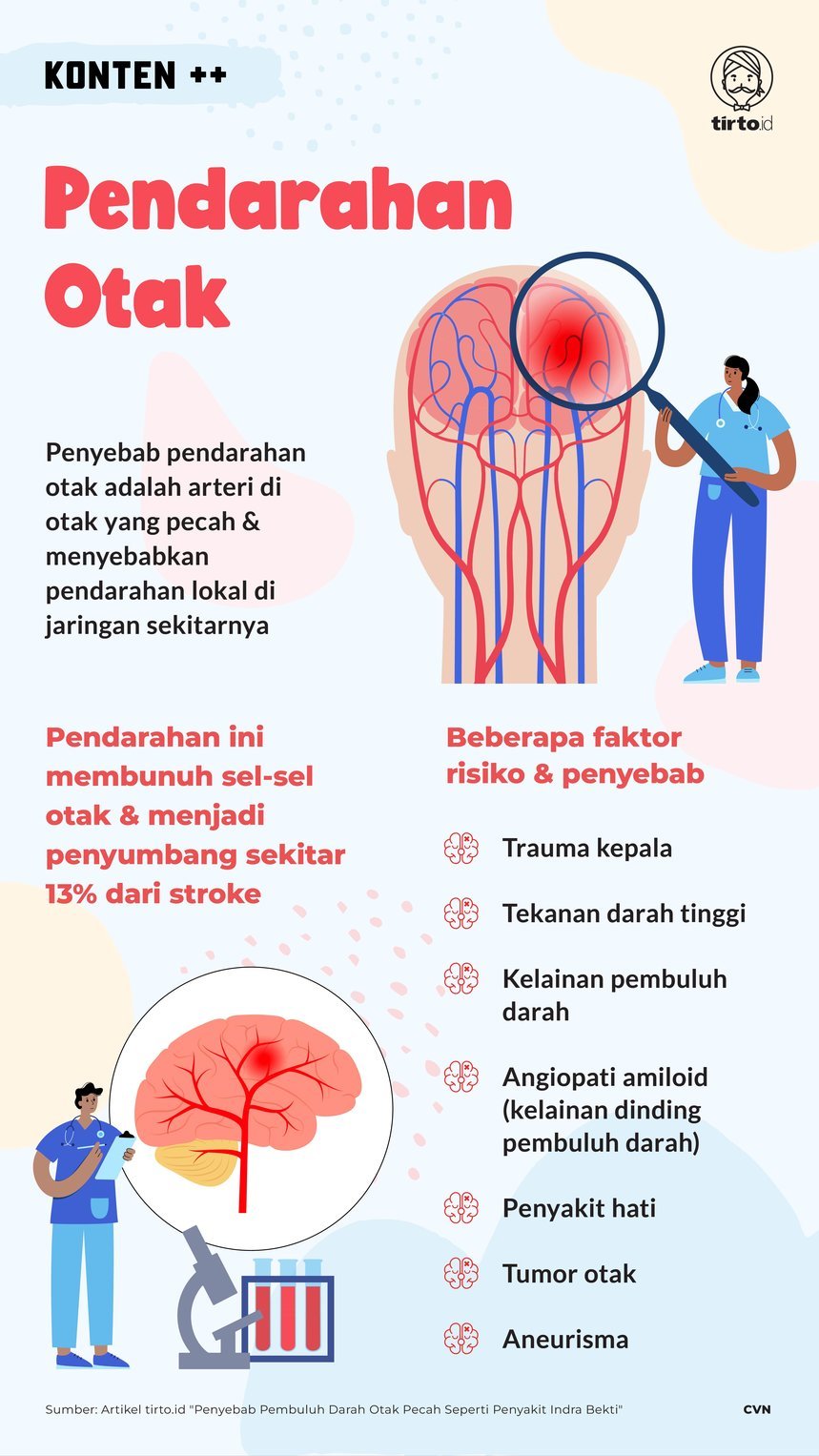 Penyebab Pembuluh Darah Otak Pecah Seperti Penyakit Indra Bekti