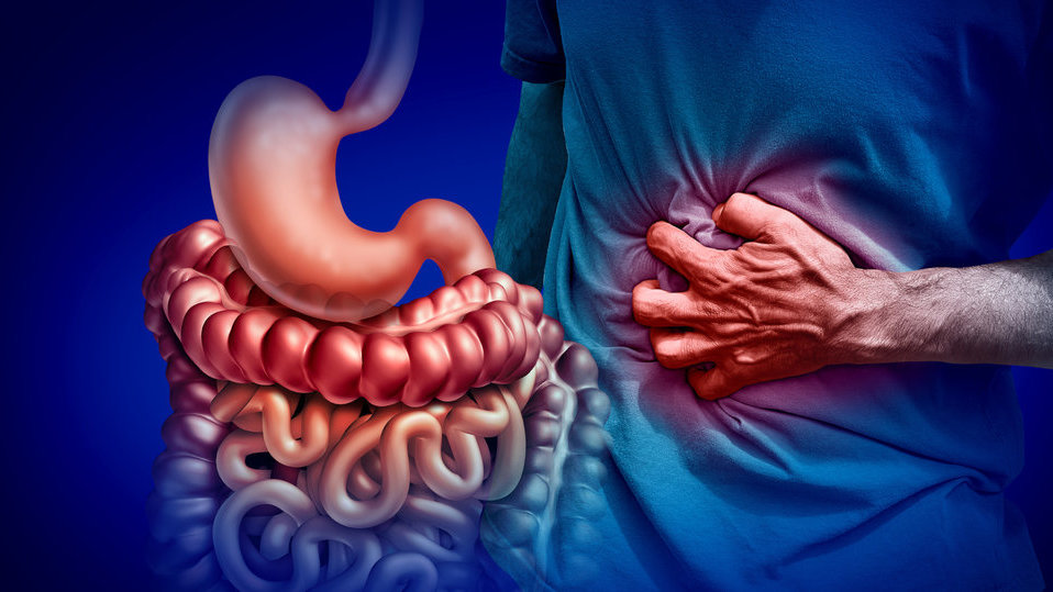 Ilustrasi Penyakit Crohn. FOTO/iStockphoto Ilustrasi Penyakit Crohn