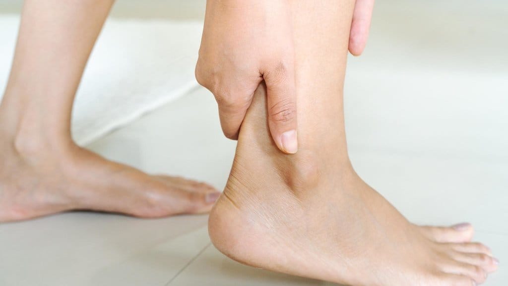 Ilustrasi Kaki Pecah-Pecah. foto/istockphoto Ilustrasi Kaki Pecah-Pecah