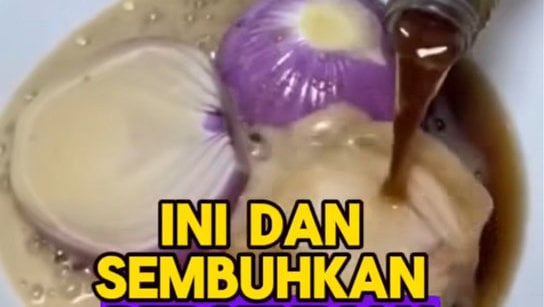 Foto Periksa Fakta Soda Untuk Radang Sendi