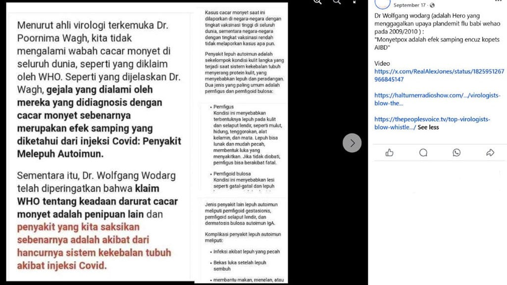 Periksa Fakta Vaksin Covid-19 dengan Mpox