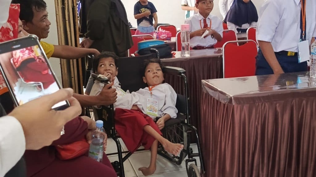 Bocah Kembar Siam