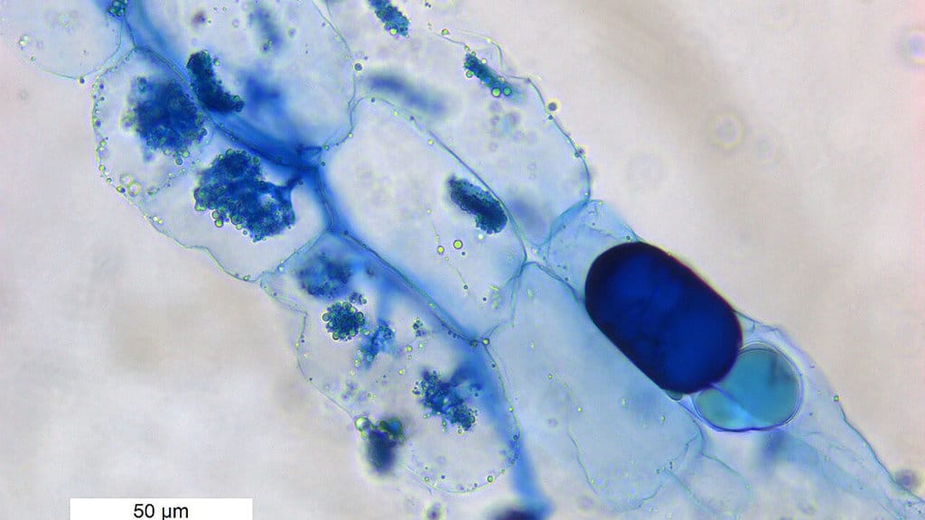 Arbuscular mycorrhizal.