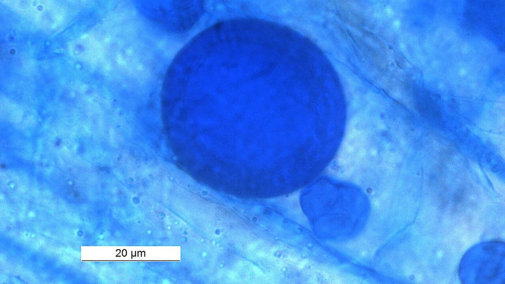 Arbuscular mycorrhizal
