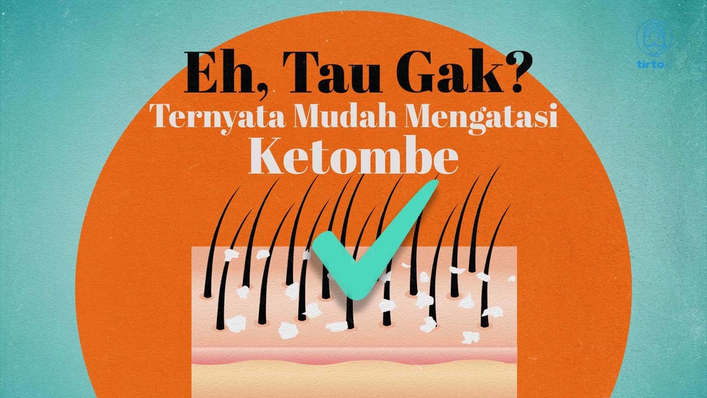 Eh, Tau Gak? Ternyata Mudah Mengatasi Ketombe
