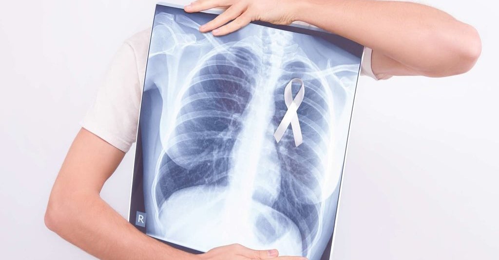 Penyakit paru-paru menahun black lung dapat disebabkan oleh